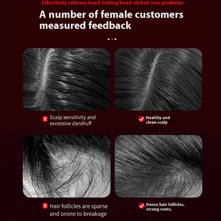 Light Therapy Scalp Massager for Hair Loss & Oil Applicator